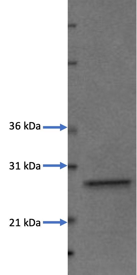 DTYMK Recombinant Protein